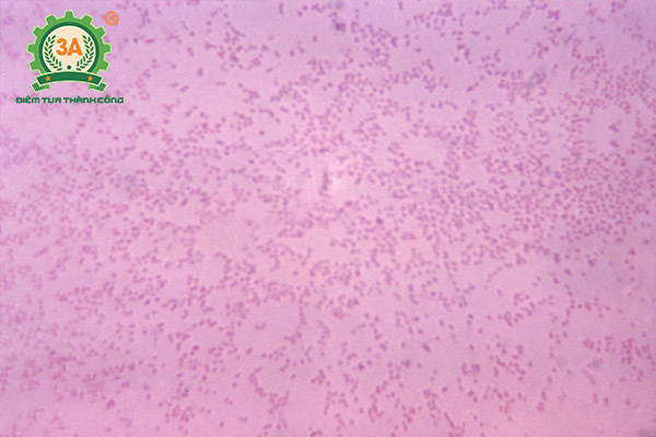 Bệnh tụ huyết trùng trâu bò (02)